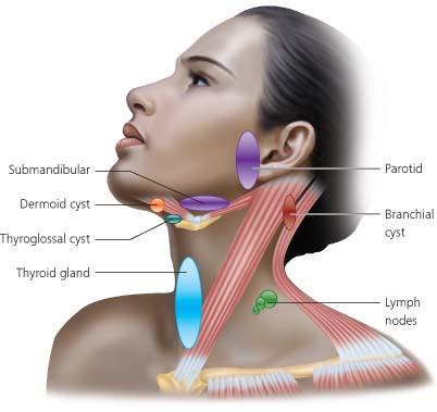 neck swelling treatment
